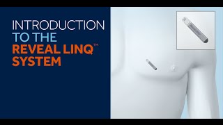 Reveal LINQ™ System Introduction for Patients [upl. by Januarius]