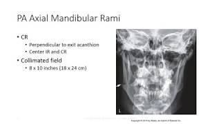 Radiographic Positioning of the Mandible [upl. by Etteuqaj]