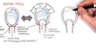 Obstetrics  Stage I of Labour [upl. by Aimo313]