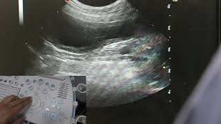 Optimising your ultrasound image [upl. by Inaleon]