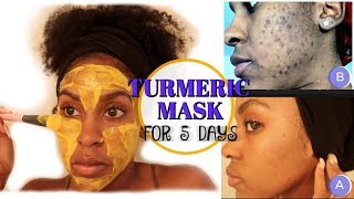 I Used a TURMERIC MASK for 1 Week and THIS HAPPENED  How to Fade Dark Spots [upl. by Leen]