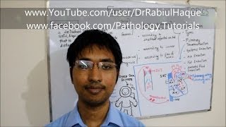 Embolism  Definition Types Pathogenesis Clinical Consequences HD [upl. by Haelhsa]