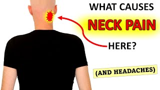 What Causes Upper Neck Pain And Headaches [upl. by Adnicaj]