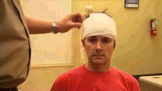 Bandaging Head Bandage [upl. by Lacefield]