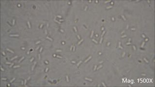 Bacteria under the Microscope E coli and S aureus [upl. by Pappas]