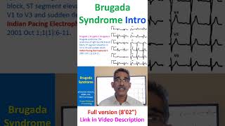 Brugada syndrome [upl. by Teri924]