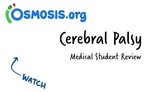 Cerebral Palsy  Clinical Review [upl. by Enneibaf]