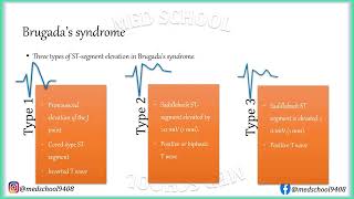 Brugada Syndrome  Osmosis [upl. by Bland767]