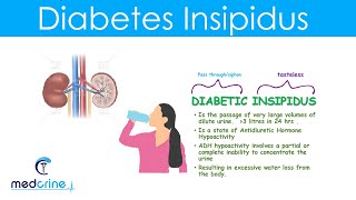 Diabetes Basics What Is Diabetes [upl. by Jd78]