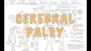 Cerebral Palsy  DETAILED Overview [upl. by Azne]