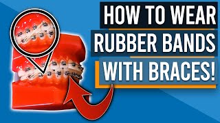 HOW TO WEAR RUBBER BANDSELASTICS WITH BRACES [upl. by Katine]