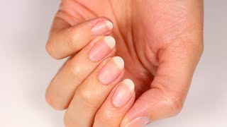 How to Whiten Yellow Nails [upl. by Ailuj]