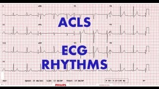 ACLS  ECG rhythm recognition amp management Part 1 [upl. by Merlin]