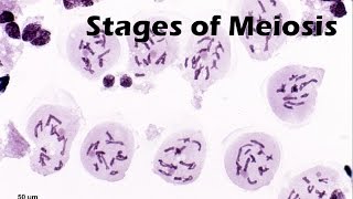 Stages of Meiosis [upl. by Jill]