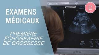 La première échographie de grossesse  Examens grossesse [upl. by Napas]