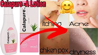 Calapure A Lotion Uses  Calamine Lotion  Review in English [upl. by Pillow]