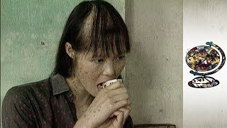 The Horrific Impact Of Agent Orange In Vietnam 2003 [upl. by Lotty]