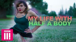 My Life With Half A Body Living Differently [upl. by Silvio]