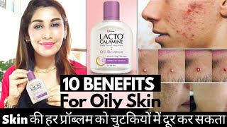 10 Uses of Lacto Calamine Lotion for Pimples Oily Skin Blackheads Acne Prone skin  Dr Menka [upl. by Jereld]