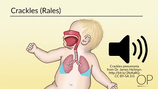 Respiratory Assessment by B Leary L DelSignore  OPENPediatrics [upl. by Dleifxam]