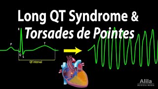 Long QT Syndrome and Torsades de Pointes Animation [upl. by Musette950]