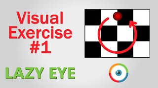 Eyelid ptosis physical examination [upl. by Anehs]