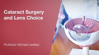 Cataract Surgery and Lens Choice [upl. by Ateuqirne]