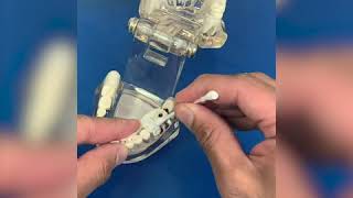 How to use temporary dental filling material [upl. by Dewhurst]