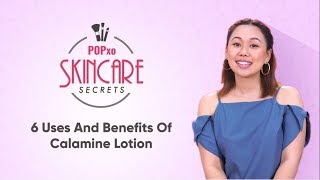 6 Uses And Benefits Of Calamine Lotion  POPxo Skincare Secrets [upl. by Ahsilem759]