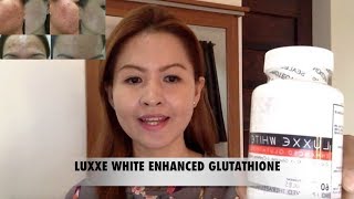 Luxxe White Enhanced Glutathione  Review [upl. by Nomae56]