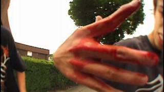 Skateboarding accidents falls crashes bails and pain Compilation [upl. by Burl]