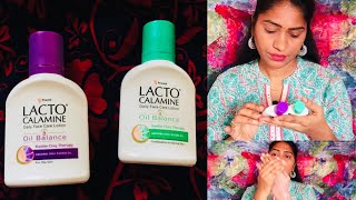 Lacto Calamine Review In தமிழ் [upl. by Sink891]