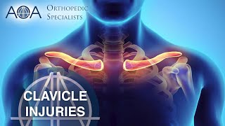 AOA Orthopedic Specialists  Clavicle Injuries [upl. by Ecnarret]