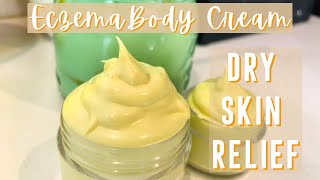 How to Make Homemade Eczema Cream  DIY Natural Itch Relief for Dry Skin [upl. by Eoin275]