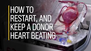 How to restart and keep a donor heart beating [upl. by Gusti741]