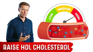 CHOLESTEROL and HEART DISEASE Dr Rajsrees Comprehensive Guide [upl. by Rambow]