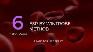 ESR by Wintrobe Method [upl. by Ecirtel286]