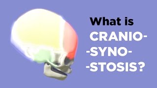 Chapter 2 Torticollis Infant Repositioning for Plagiocephaly [upl. by Ettelimay]