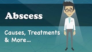 Abscess  Causes Treatments amp More… [upl. by Winona]