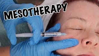 Mesotherapy Facial  Anti Aging Treatment [upl. by Pretrice697]