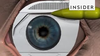 Clinical testing extraocular muscles tutorial [upl. by Mazel296]