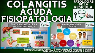 COLANGITIS FISIOPATOLOGÍA  GuiaMed [upl. by Seyer]