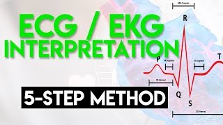 ECG Interpretation Made Easy  ECG EKG Interpretation Part 2 [upl. by Hsina]