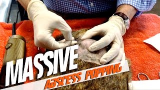 Massive Abscess Popping [upl. by Gellman]