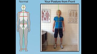 Postural Assessment Guide [upl. by Airot]