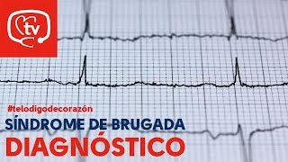 Syndrome de Brugada  une maladie cardiaque héréditaire  Le Magazine de la Santé [upl. by Chrisy]