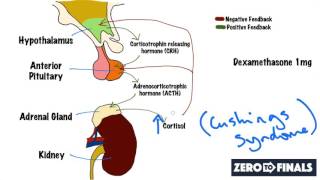 Understanding The Dexamethasone Suppression Test [upl. by Aicena]