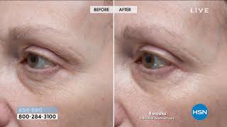 StriVectin Intensive Eye Concentrate for Wrinkles [upl. by Aig30]