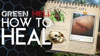 Green Hell  How to HEAL any condition [upl. by Noteek]