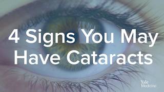 What Are Cataracts  A Closer Look At Cataracts [upl. by Durand626]